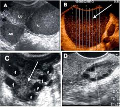 Protegido: Patologías ginecológicas II