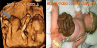 CLASE 17 ECO MORFOESTRUCTURAL ABOMEN FETAL