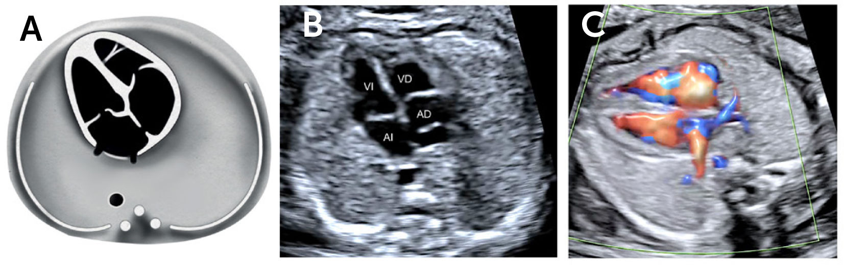 CLASE 16 ECOCARDIOGRAFIA FETAL