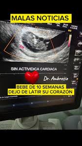 CLASE 12 VIABILIDAD DEL EMBARAZO NUEVOS CONCEPTOS