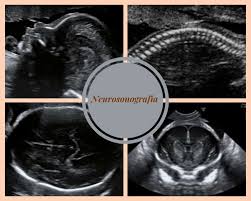 Protegido: CLASE 14 ECO MORFOESTRUCTURAL CRANEO Y NEUROSONOGRAFIA FETAL