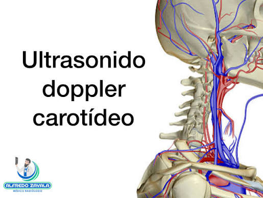 CLASE 40 ECOGRAFI DOPPLER CAROTIDEA