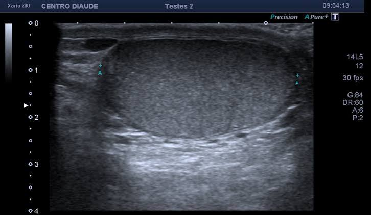 CLASE 35 ECOGRAFIA TESTICULAR NORMAL Y PATOLOGICA